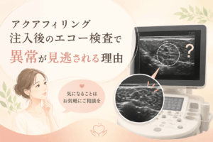 アクアフィリング エコー
