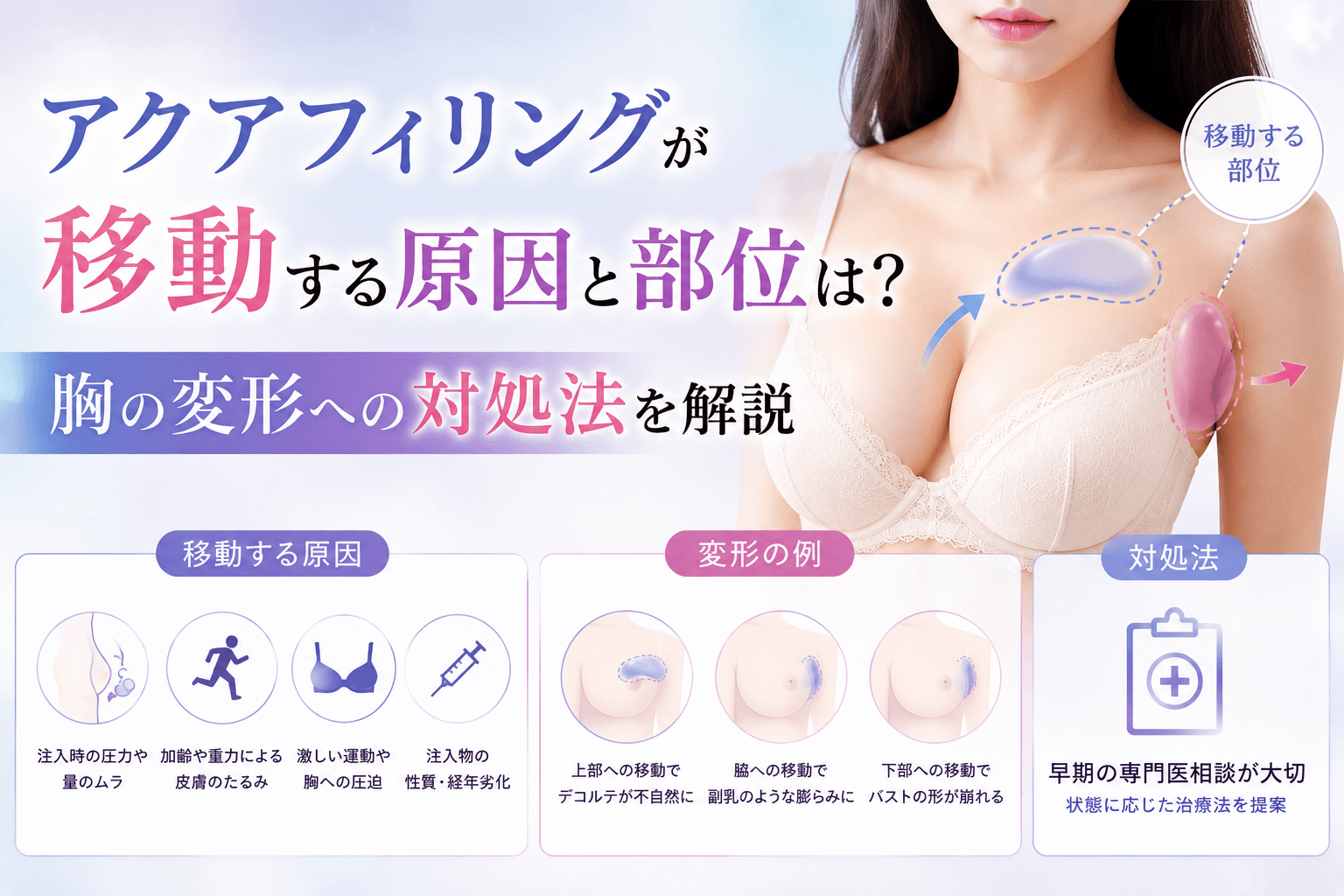 アクアフィリング 移動