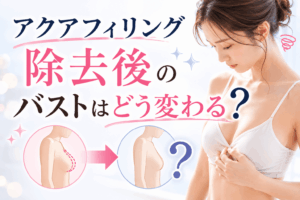 アクアフィリング除去後 バスト