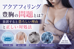 アクアフィリング問題