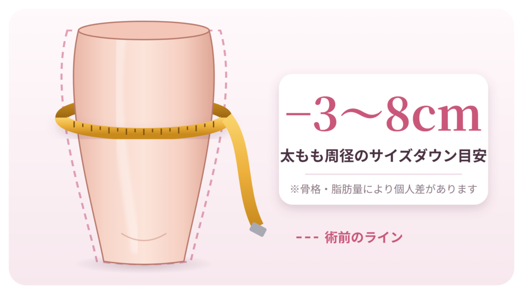 マイナス3〜8センチ程度のサイズダウンが期待できる