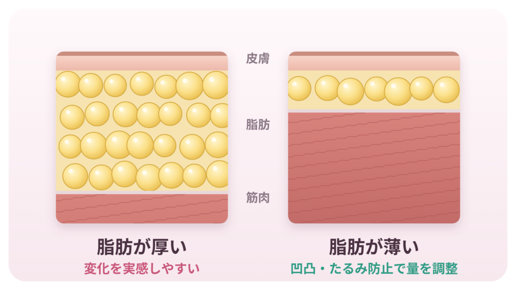 脂肪の除去量には個人差がある
