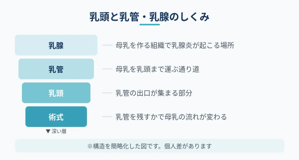 乳頭縮小と乳腺炎の関係を乳腺・乳管・乳頭の役割で整理した図