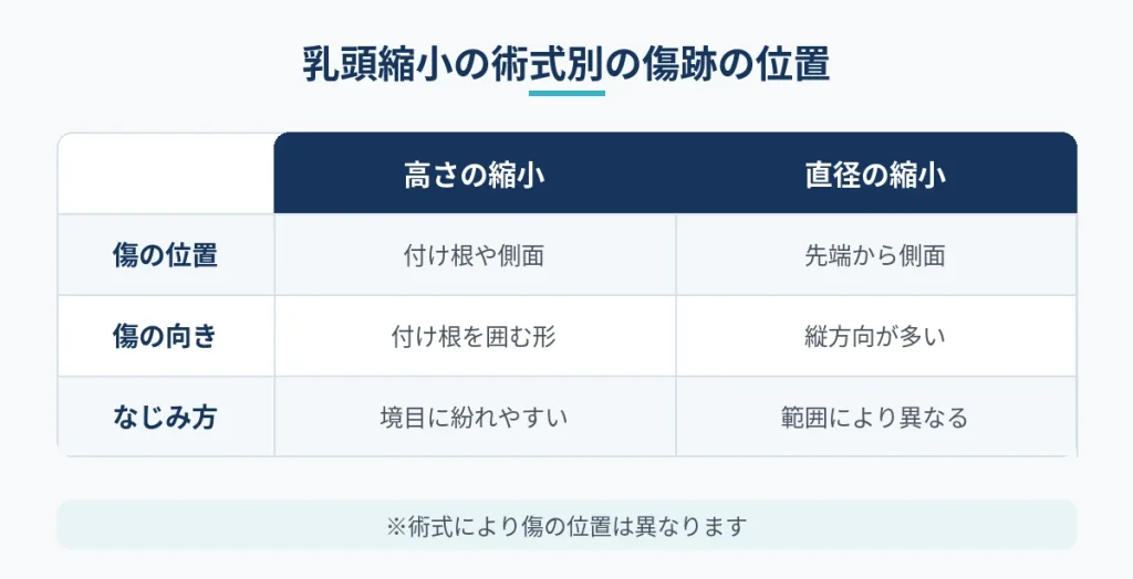 乳頭縮小で高さと直径を縮める場合の傷跡の位置の比較