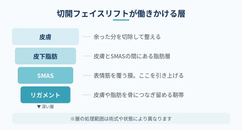 切開フェイスリフトで引き上げる顔の皮膚からSMAS筋膜、リガメントまでの層構造