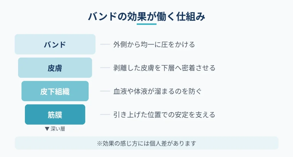 切開フェイスリフト後のバンドが皮膚や組織に働く仕組みの図