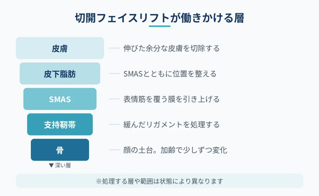切開フェイスリフトの若返りで働きかける皮膚からSMASまでの層の図
