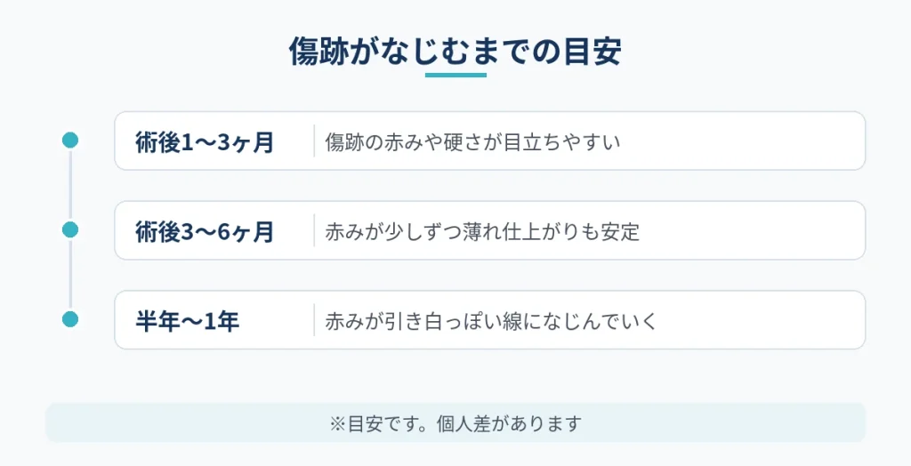 切開フェイスリフトの傷跡が半年後から1年にかけてなじむ経過の目安