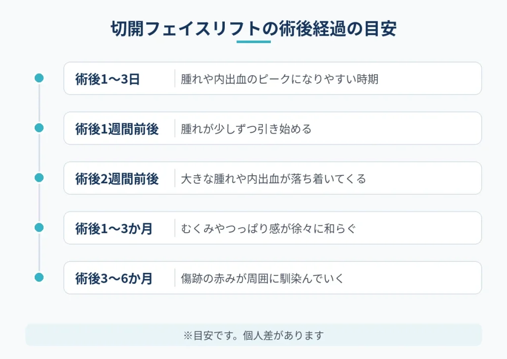 切開フェイスリフト術後の腫れや傷跡が落ち着くまでの経過の目安
